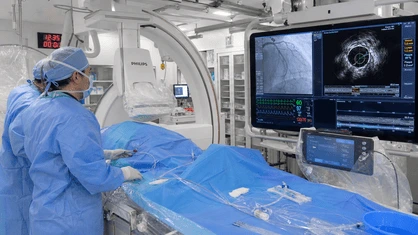 Estudio hemodinámico coronario