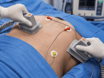 Cardioversión eléctrica