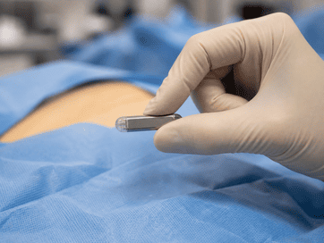 Holter subcutáneo